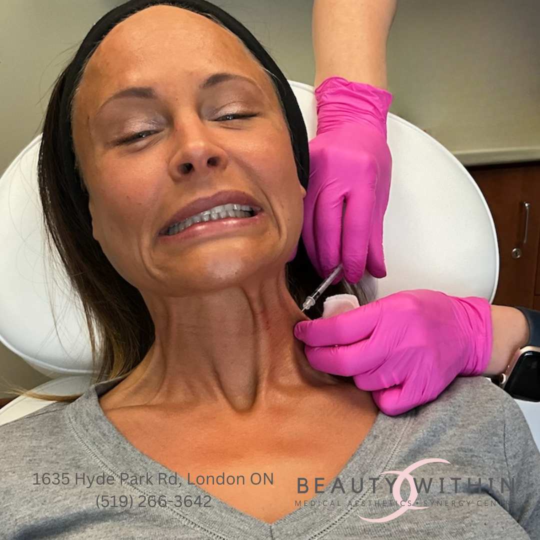 Botox relaxes the neck's platysma muscle